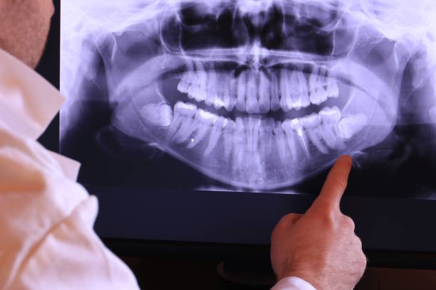 Best Root Canal Emergency Dentist  in Meadow Vista, CA